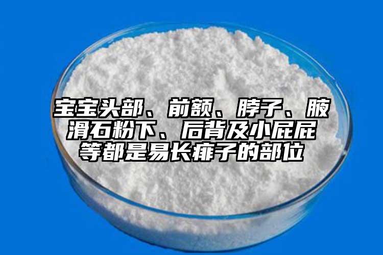 寶寶頭部、前額、脖子、腋滑石粉下、后背及小屁屁等都是易長痱子的部位